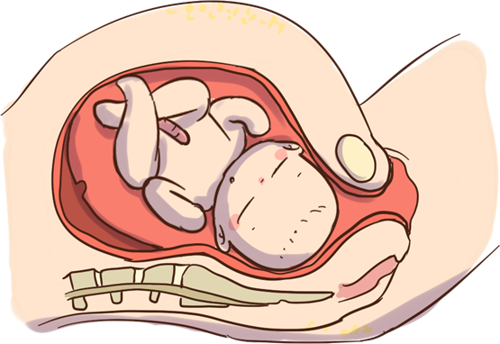 28圈观察 | 子宫脱垂是什么 麦特斯磁刺激仪助力女性盆底康复